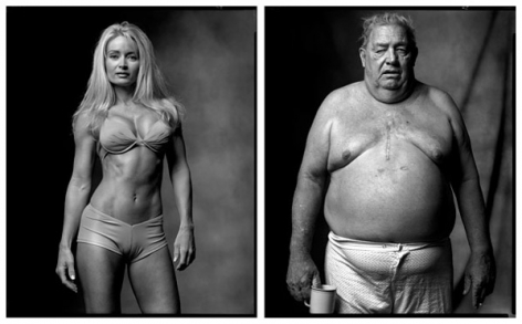 Fitness Model / Heart Surgery Patient, 2002 / 2005, 20 x 32-1/2 Diptych, Archival Pigment Print, Ed. 20